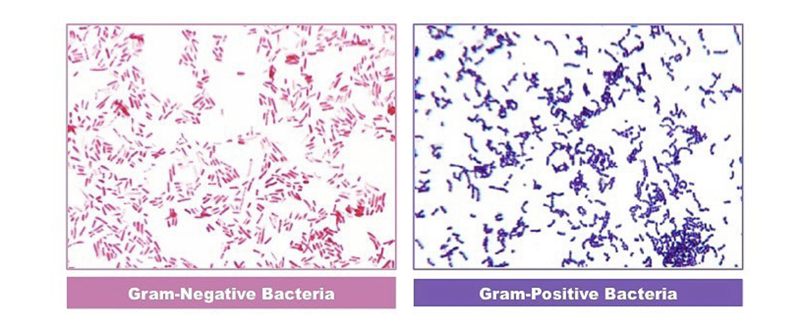 Gram Staining Procedure: Step-by-Step Techniques and Accurate Interpretation